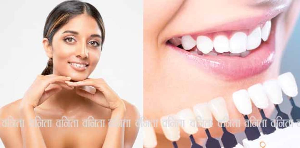 smile-1