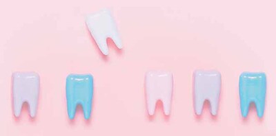 milk-teeth-2 milk-teeth-2